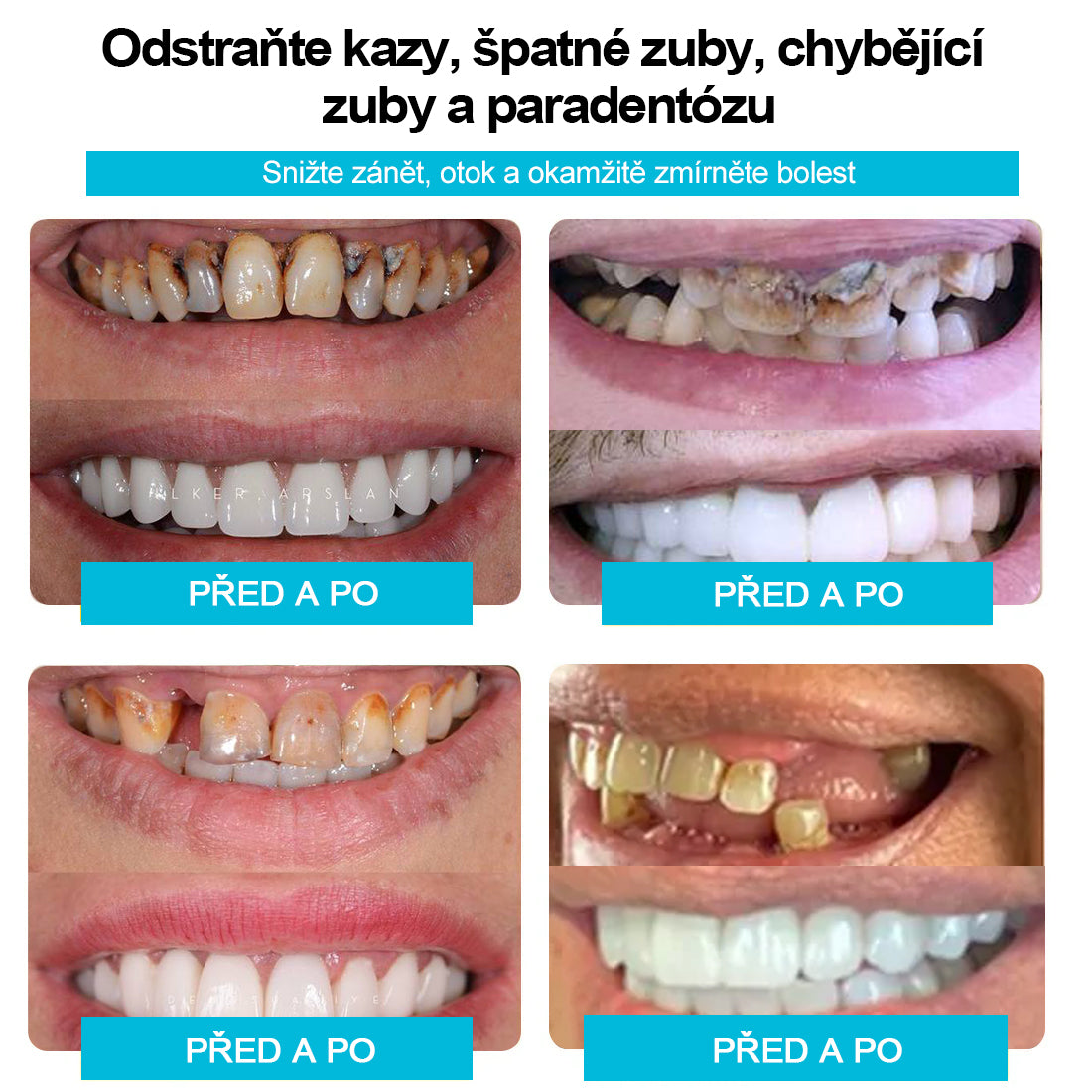 🦷🎁 Abychom vrátili důvěru našim novým zákazníkům, měli jsme to štěstí dát nabídku 5𝟎% z nejvyšší slevy po omezenou dobu, přeskočit tentokrát zpět na normální cenu!