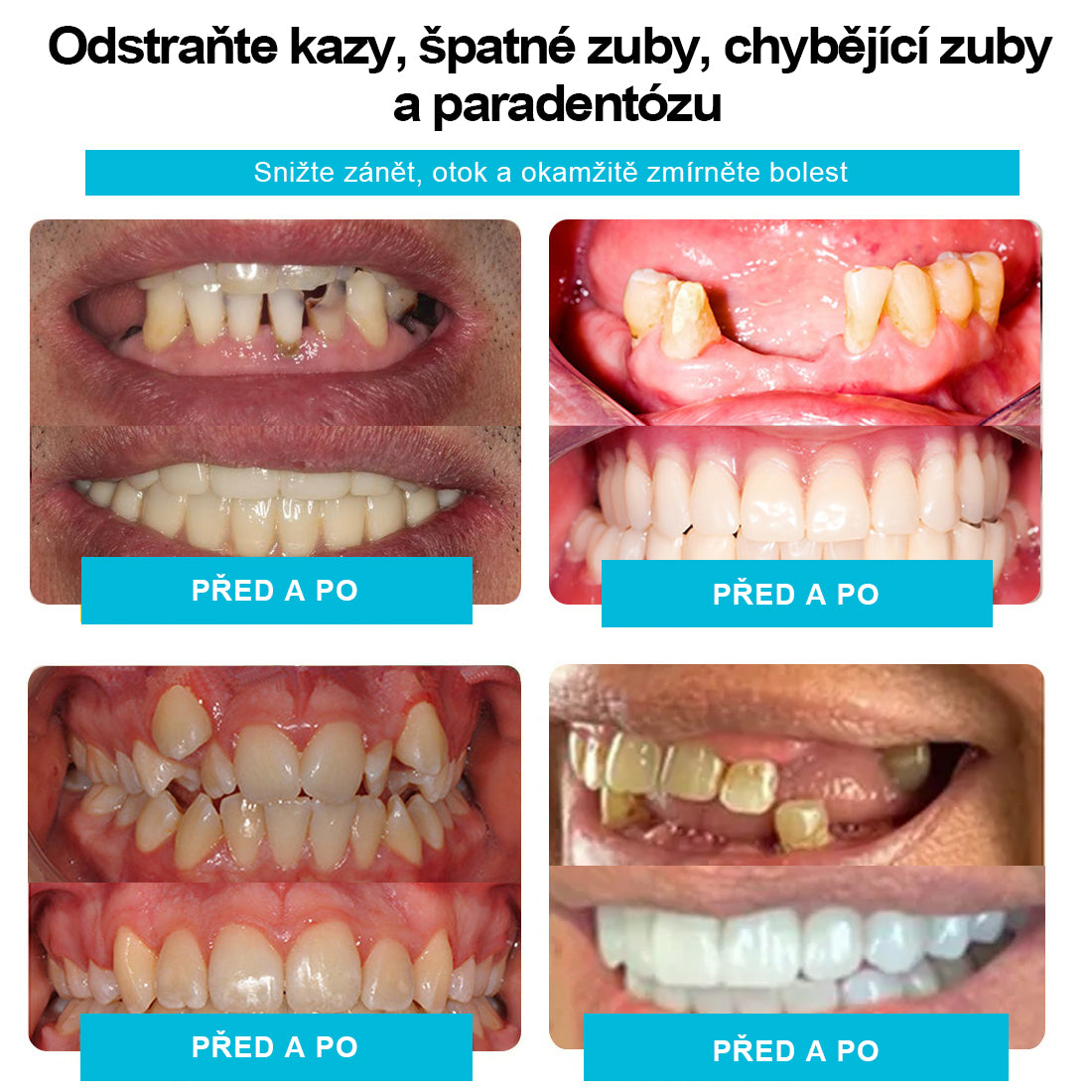 🦷🎁 Abychom vrátili důvěru našim novým zákazníkům, měli jsme to štěstí dát nabídku 5𝟎% z nejvyšší slevy po omezenou dobu, přeskočit tentokrát zpět na normální cenu!